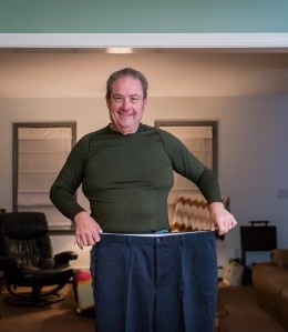 Harry Haigh lost more than 100 pounds after weight-loss surgery