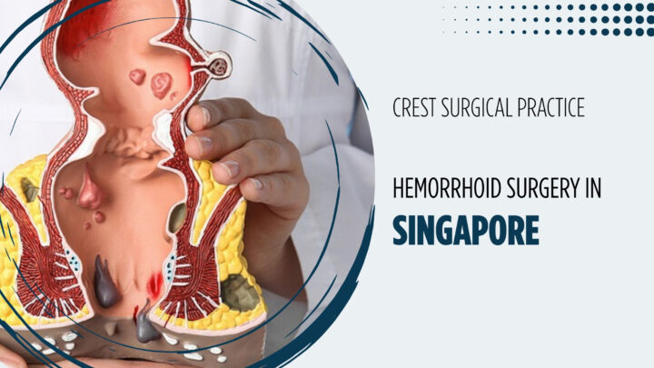 hemorrhoid surgery